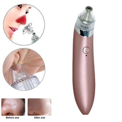 Electric Blackhead Remover Facial Pore Vacuum with 4 Heads